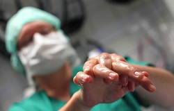 Chirurgin mit Mundschutz desinfiziert die Hände in der Orthopädie der Uniklinik Rostock