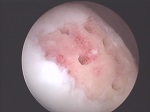 schwarzer Kreis mit Blick in eine weiß-rosa Gelenk in der Orthopädie der Uniklinik Rostock