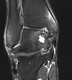 Röntgenaufnahme Kniegelenk in der Orthopädie der Uniklinik Rostock